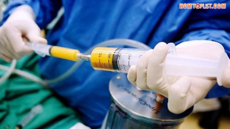 nang-nguc-bang-cay-mo-tu-than-hcmtoplist