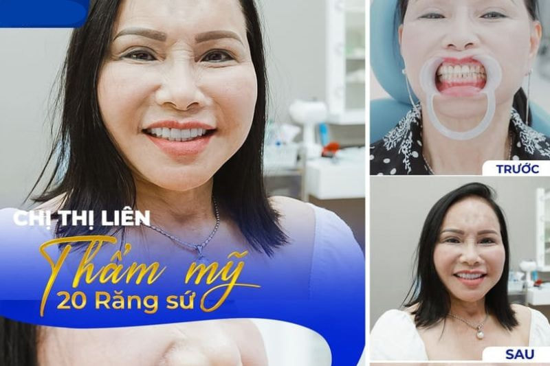 Dia-chi-boc-rang-su-quan-phu-nhuan-uy-tin-gia-tot-hcmtoplist-1